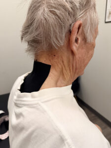 Does Neck Taping Improve Forward Head Posture?
